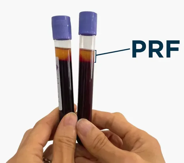 PRF